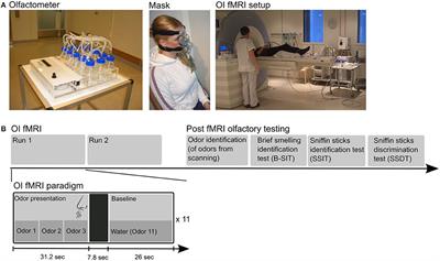 The Human Brain Representation of Odor Identification in Amnestic Mild Cognitive Impairment and Alzheimer's Dementia of Mild Degree